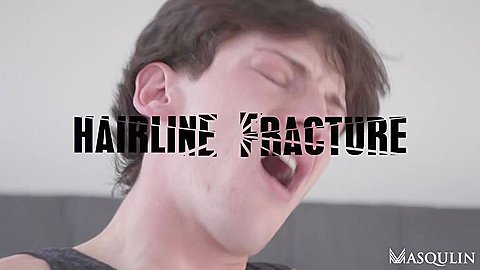 Hairline Fracture - Bro Network