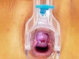 Huge natural melon size tits at obgyn doc