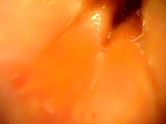 Japanese rectal exam