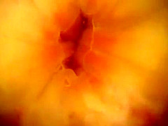 Japanese rectal exam