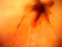 Japanese rectal exam